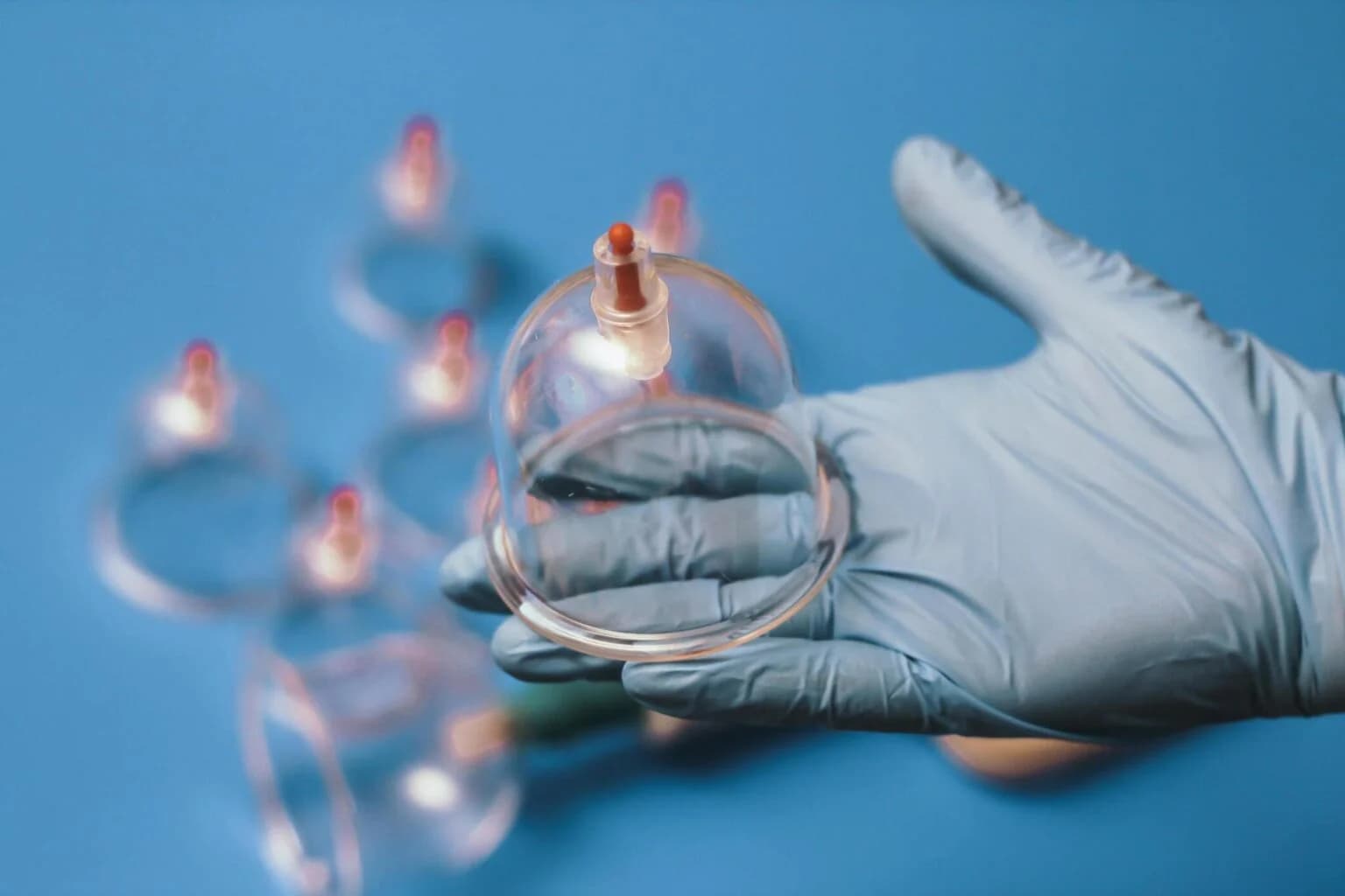 What Is Hijama Cupping?