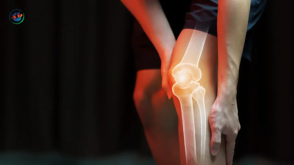 Does Hijama Help Severe Knee Pain