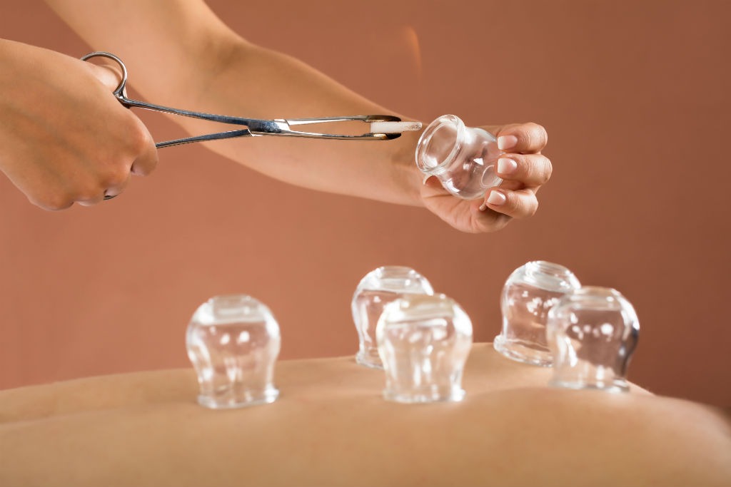 Fire Cupping Hijama Nation