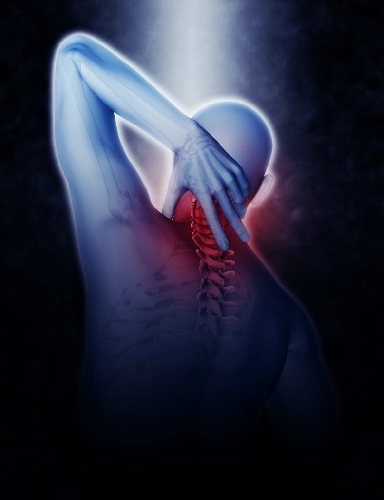 Hijama Treatment for Skeletal Issues