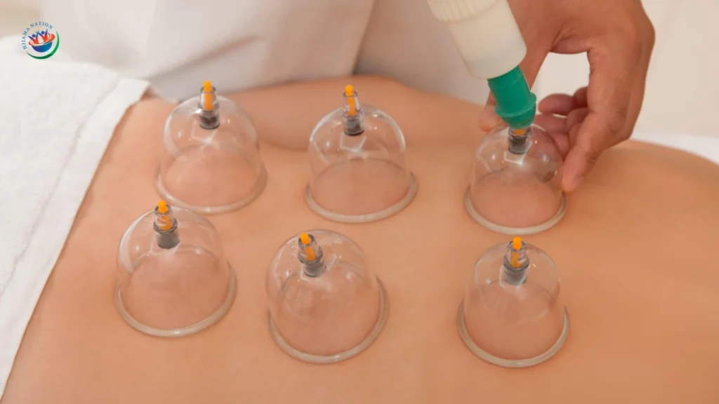 cupping therapy for cough
