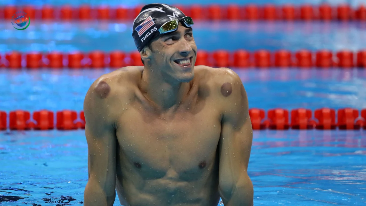 What’s the Deal with All the Olympics and Hijama Cupping Therapy Hype