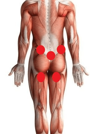 Hijama Treatment For Haemorrhoids