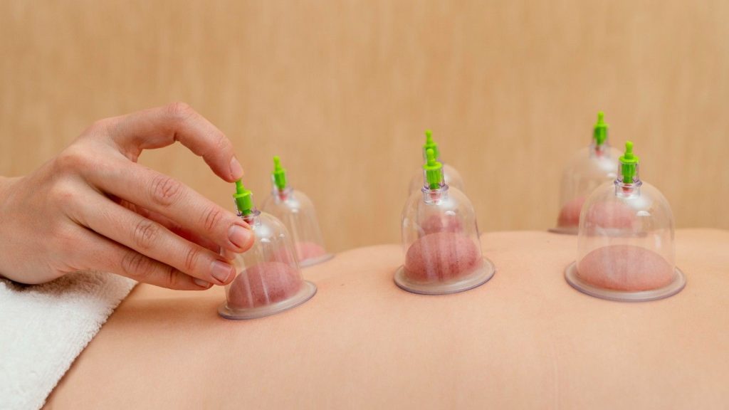 Hijama Treatment For Skeletal Issues.