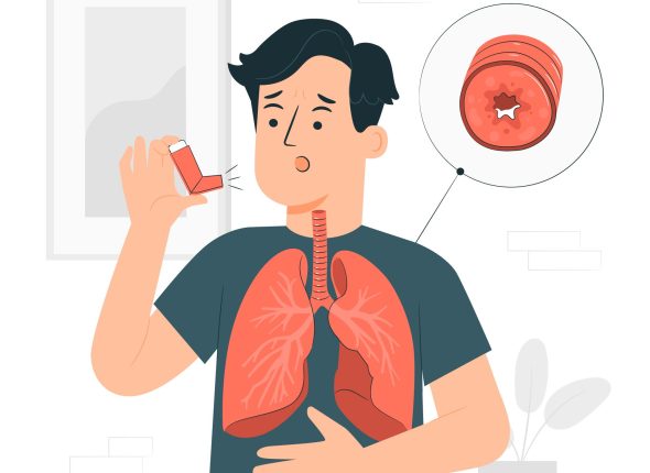 Hijama Cupping Therapy for Asthma