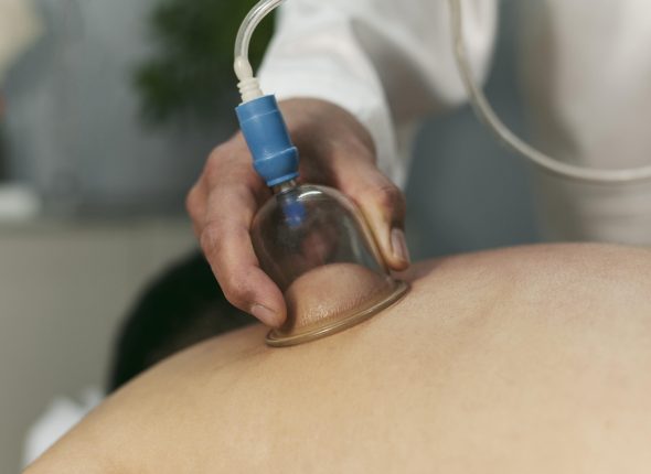 Benefits of Cupping Therapy for Athletes